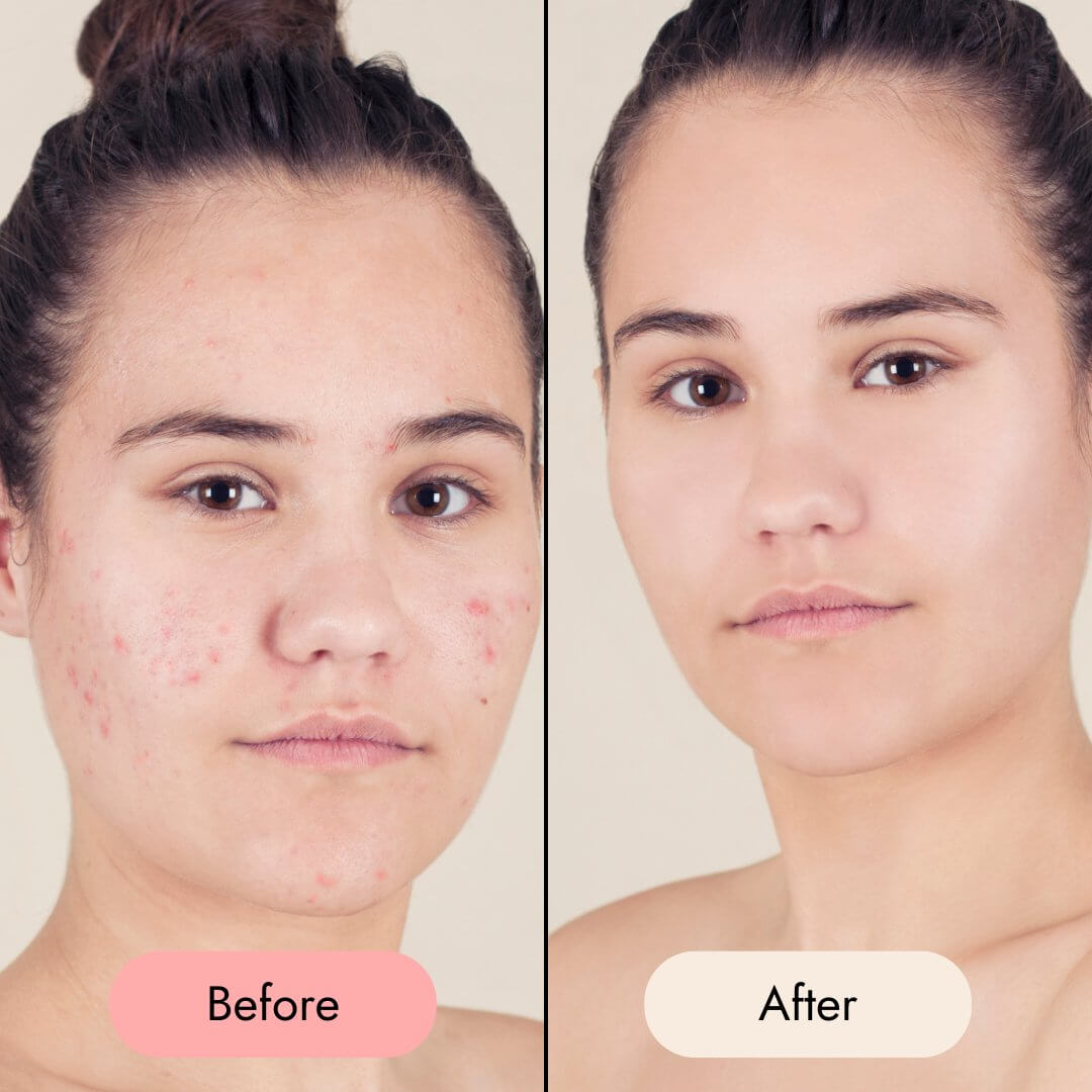Purifying Mousse - Zesty Beauty LTD