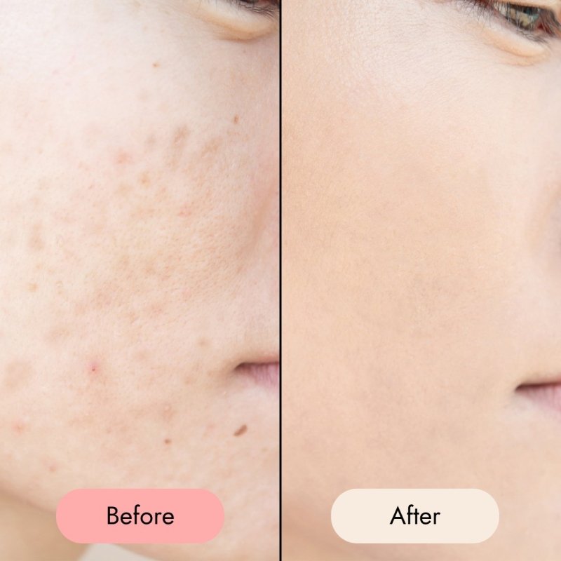 All - In - One Facial Oil - Zesty Beauty LTD