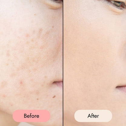 All - In - One Facial Oil - Zesty Beauty LTD